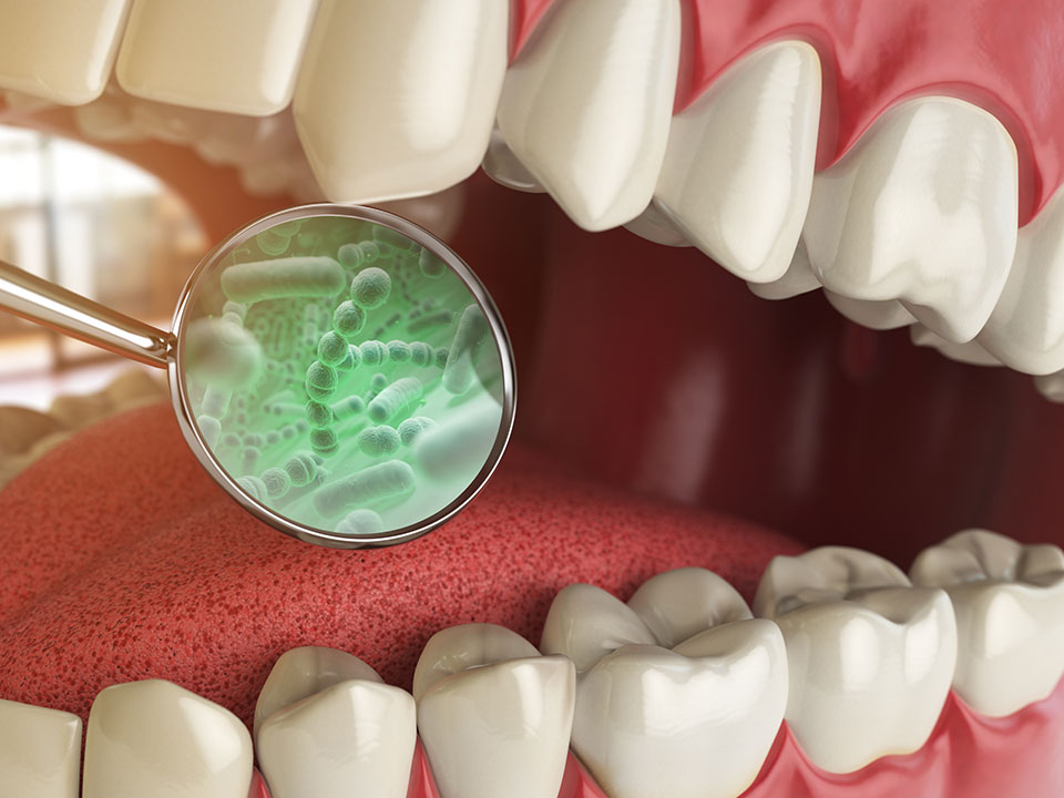 Bakterie występujące w jamie ustnej są częstą przyczyną gorzkiego smaku