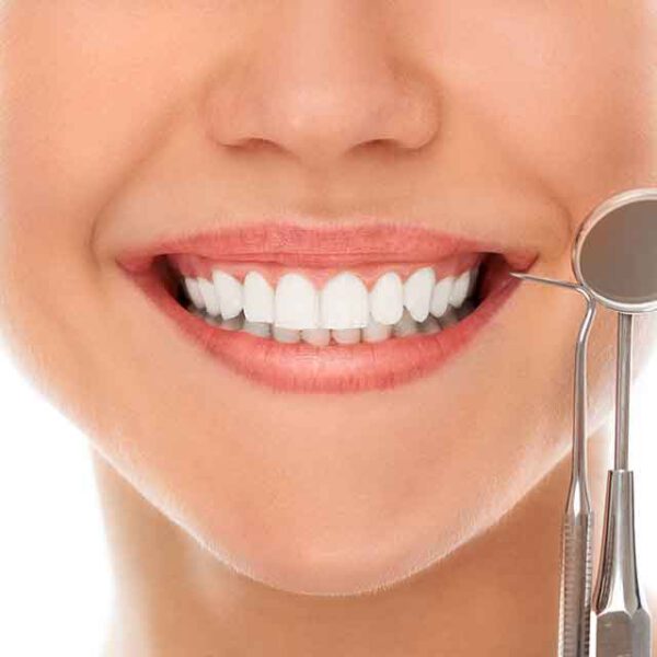 Bonding zębów — co to jest